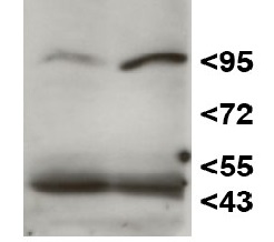 HEN1 | HUA ENHANCER 1 in the group Antibodies Plant/Algal / DNA/RNA/Cell Cycle / plant RNA at Agrisera AB (Antibodies for research) (AS15 3095)